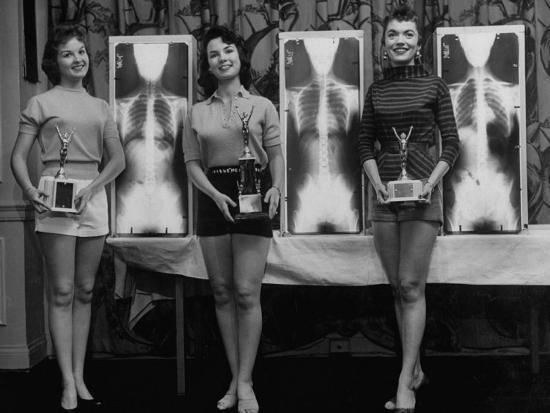 A black and white photo of three white women holding trophies, standing next to x-ray images of their supposed perfect spines.